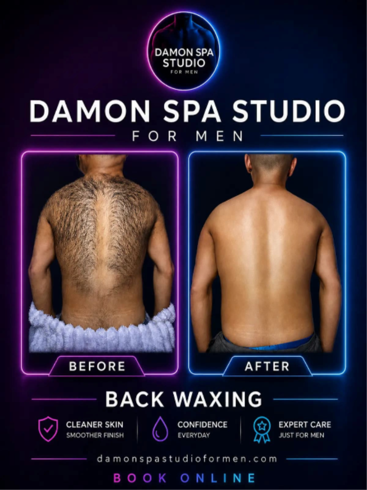 Back waxing for men at Damon Spa Studio for Men in Vancouver located in downtown, next to Davie Village in West End. Photos before and after treatment.